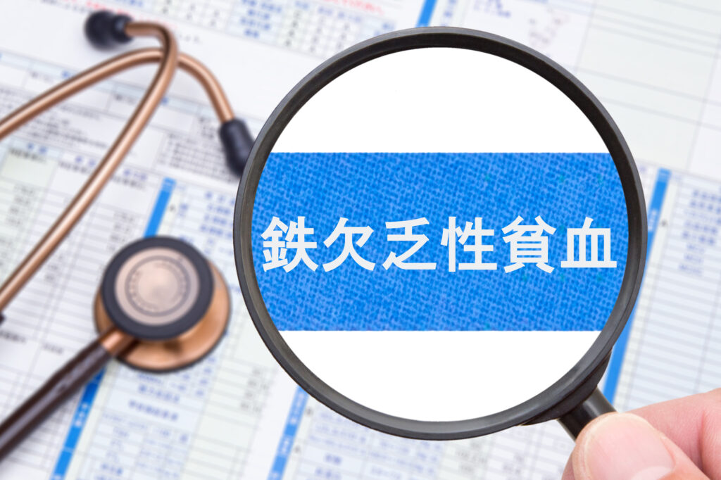 健康診断で貧血を指摘されたらどうすればいい?危険な数値と体からのサインを見逃さないで